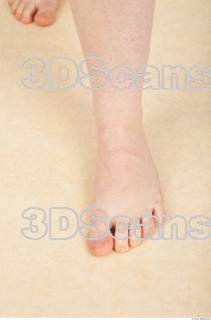 Photo reference of foot 0002